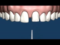 Co-van de de Precisiegehechtheid van Cr MK1 de Weerstand van de het Gebitcorrosie