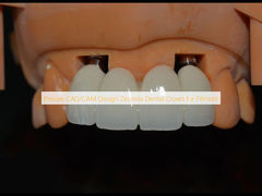 Precise CAD/CAM Design Zirconia Dental Crown for Fitment