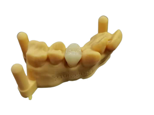 OEM 3D Tand het laboratorium Digitaal Ontwerp van het Druk Flexibel Acrylgebit