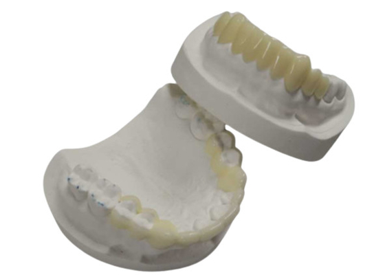 Hoge duurzaamheid CAD CAM 3D-printen Tijdelijke kronen Duurzame hars
