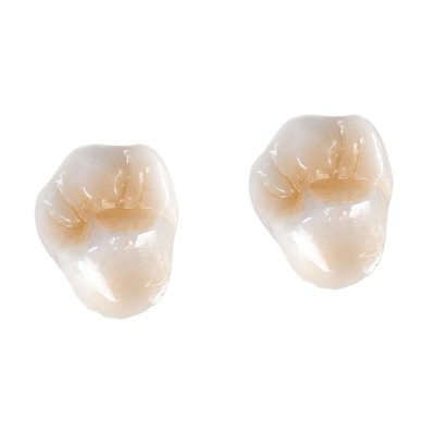 Alle-ceramisch FDA 3014652903 het Vernisjeinlegsel Onlay van de Zirconiumdioxyde Tandkroon