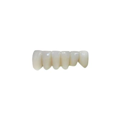 Op maat gemaakte tandkronen van zirconia Uitstekende esthetiek Duurzaam materiaal