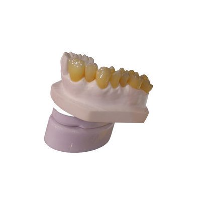 CAD CAM het Laboratorium 3D Printer Dental Crowns van de Ontwerppfm Tandkroon