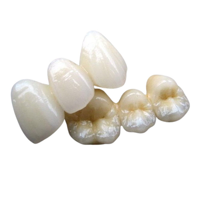 PFM-Cr 3014652903 van Co Ceramische Tand de Kleurenstabiliteit van de Brugdouane