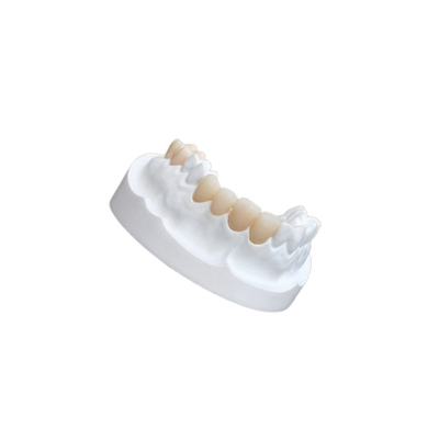 IPS E Max Ceramic Dental Crown Comfortable Porselein Samengestelde Vernisjes