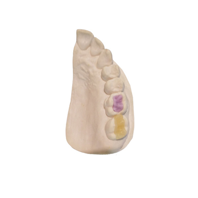 Hoge douane - van de Keramiekfda van de dichtheidsdouane de Tand alle-Ceramische Kroon