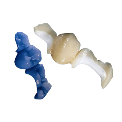 Aangepaste OEM die het alle-Ceramische Tandinlegsel Onlay oppoetsen van het Kroonvernisje