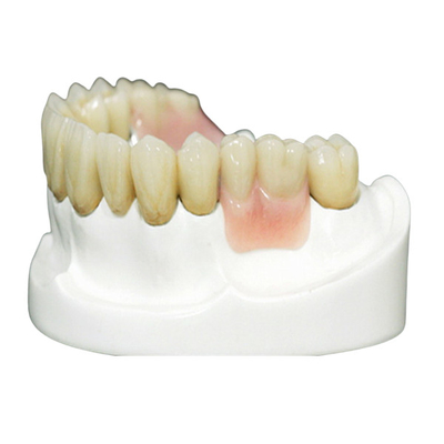 MK1 Precision Fixement Prothese voor perfecte pasvorm en bescherming