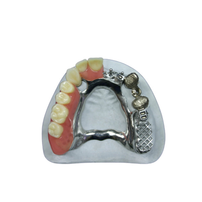 Mooi uiterlijk Precieze bevestiging Prothese Implantaten bevestigingen