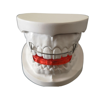 Douaneoem Eenvoudige de Orthodontie van het Tandinstelmechanisme installeert Gemakkelijk handhaaft