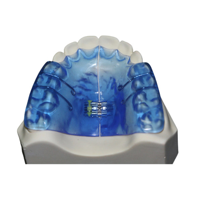 Orthopedische Tandinstrumenten met Hoge Stabiliteit en Goede Biocompatibility