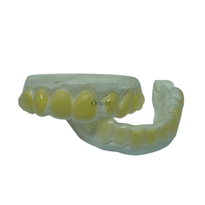 Zijn de Orthodontische Toestellen van FDA Corrosiebestendig en Duurzaam