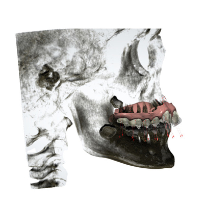 Het aangepaste Rubber bevestigde Orthodontische Gemakkelijke Toestellen handhaaft