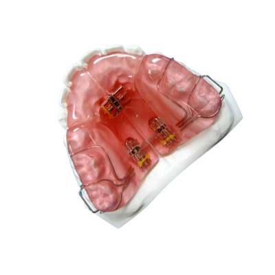 Hoge Functionele het Toestellen Orthodontische Rubberpal van Hardheidsfda