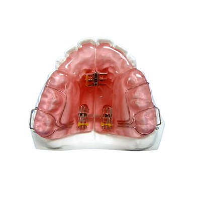 Douane Verwijderbare bevestigde OEM Orthodontische Toestellen Goede Duurzaamheid