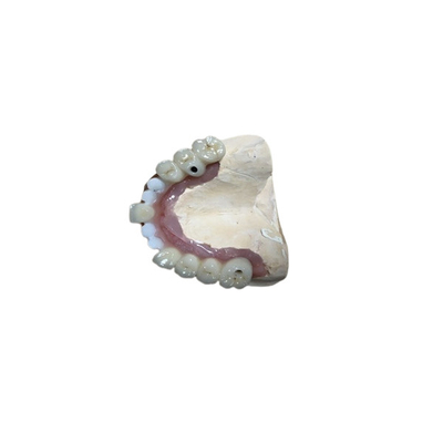 Nauwkeurige Implant van Biocompatibility Tandimplant van de Gehechtheidstand Kroon
