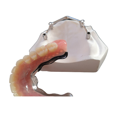 Titanium/pure titanium tandheelkundige implantaatbalk voor CAD CAM Digital Center