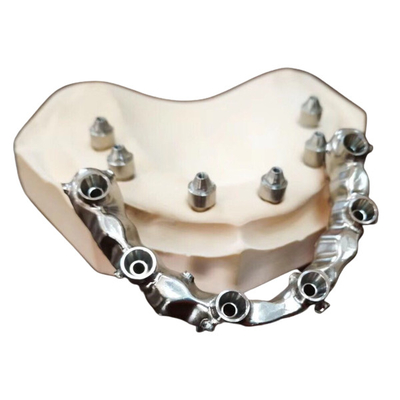 FDA 3014652903 PFM-brug tand hoogst Esthetische uiterst Sterk
