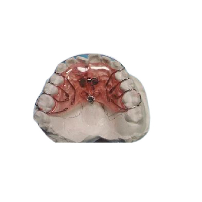 Veilige Vaste Aligners Gemakkelijke Schoonmakende Verwijderbare Vaste Orthodontische Steunen