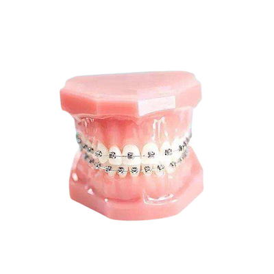 Vlot de Steun Duurzaam Vast Toestel van het Oppervlakte Orthodontisch Metaal