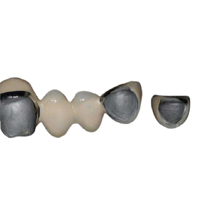 Natuurlijke van het de Legeringsporselein van Kobaltchrome de Tanden Super Corrosiebestendig