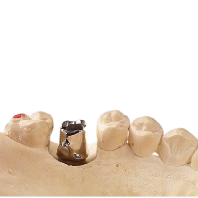 Malenprocédé Zuiver Implants van het Titaniumsteunpunt Gebruiksgoed Biocompatibility