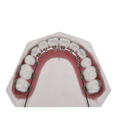 De rechte Draad bevestigde Orthodontische Toestellen voor Tanden het Rechtmaken