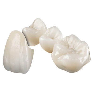 Esthetisch Stabiele Zirconiumdioxyde Ceramische Kroon die niet Implant Kroon irriteren