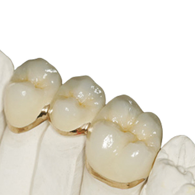 Niet Irriterende Tijdelijke Harskroon met Goede Biocompatibility