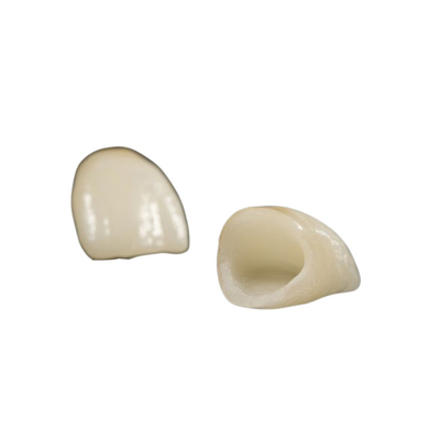 Tandheelkundig herstel laboratorium gespecialiseerd in Zirconia Repair met Precise Fitting