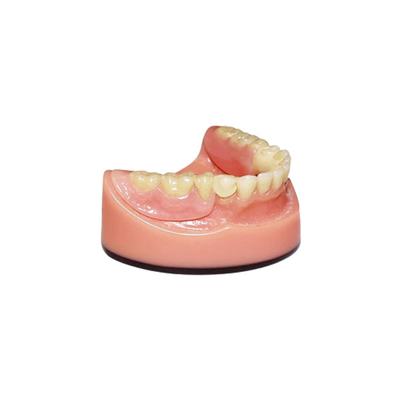 OEM PFM Tand de Weergavesysteem van het Brug 3D Digitaal Intraoral Aftasten