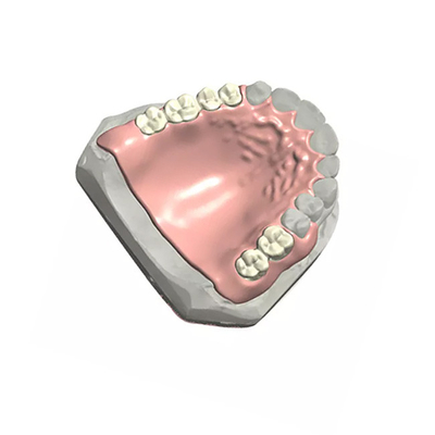 Verwijderbare Tand Gedeeltelijke Gebit Natuurlijke Kleur 3D Tand ModelCustomized