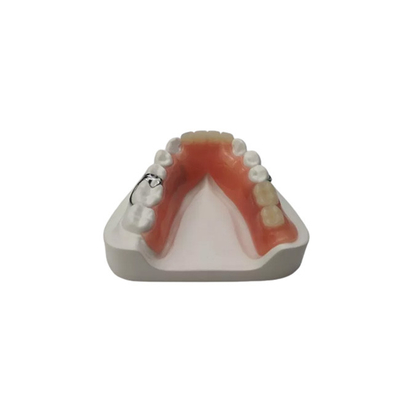 Flexibele hars kunstgebit Dental Lab tandheelkundige acryl verwijderbare gedeeltelijke kunstgebitten