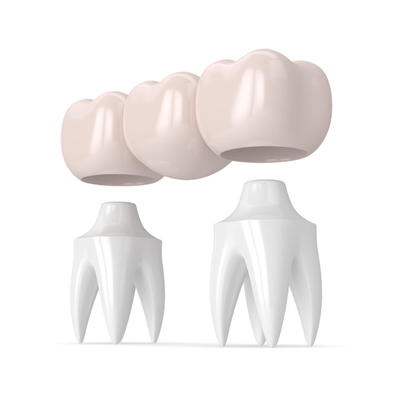 Alle-ceramische Kroonverschijning en Hardheid dichtst aan Echte Teet Transparent Gloss