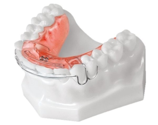 De tand Orthodontische Eenvoudige Toestellen installeren High-tech Biologisch Materiaal