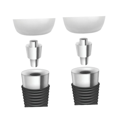 Tandimplant Bars: Hervormende Overdenture-Stabiliteit