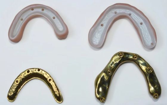 Volledige Zirconia brug met titanium staaf steun, Langdurige Titanium staaf ondersteund Zirconia kronen met bruggen
