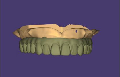 Design AOX Professional Full Arch Implant Bridge Design Service