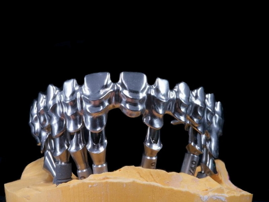 FDA 3014652903 PFM-brug tand hoogst Esthetische uiterst Sterk