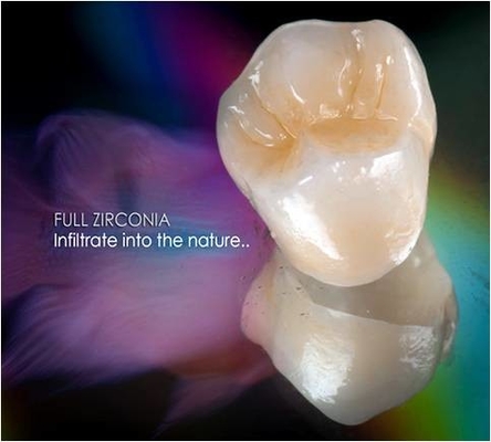 Alle-ceramisch FDA 3014652903 het Vernisjeinlegsel Onlay van de Zirconiumdioxyde Tandkroon