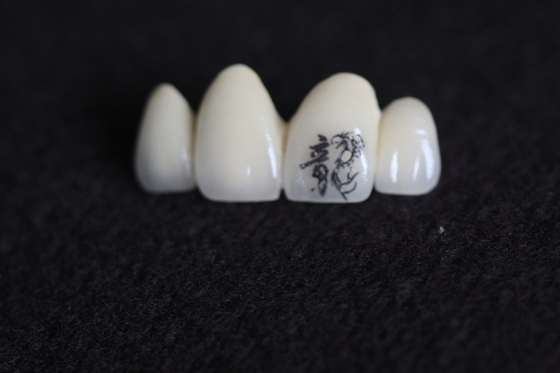PFM Dental Crown Image Aanpassing met gepersonaliseerde aangepaste patronen