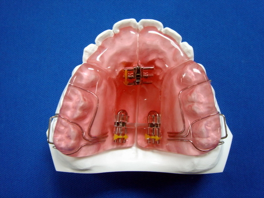 Douane Verwijderbare bevestigde OEM Orthodontische Toestellen Goede Duurzaamheid