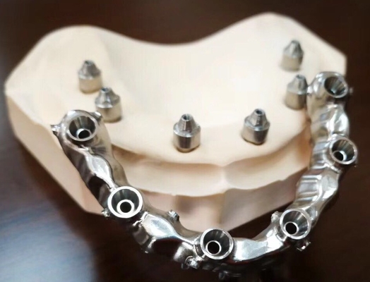 FDA 3014652903 PFM-brug tand hoogst Esthetische uiterst Sterk