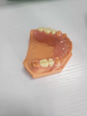 3D Gedrukte Gebitten voor TanddieLaboratoria op Digitale Gegevens worden gebaseerd