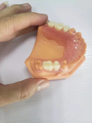 3D Gedrukte Gebitten voor TanddieLaboratoria op Digitale Gegevens worden gebaseerd