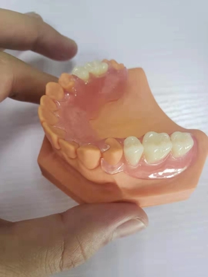 3D Gedrukte Gebitten voor TanddieLaboratoria op Digitale Gegevens worden gebaseerd