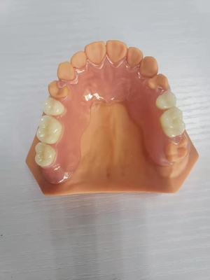 3D Gedrukte Gebitten voor TanddieLaboratoria op Digitale Gegevens worden gebaseerd
