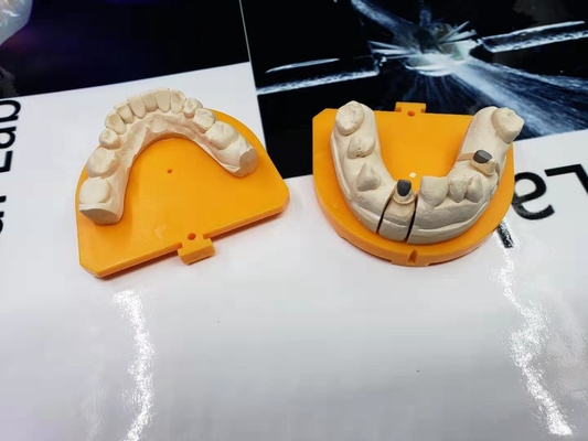De Gele Gouden Ceramische Kroon met hoge weerstand van de Porselein Tandkroon PFM
