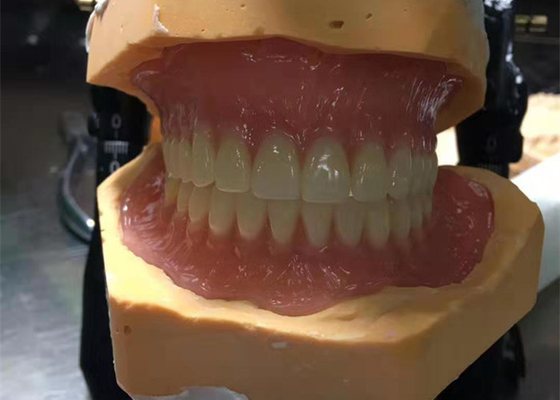 Cad-CAM de Rubber 3D Gedrukte Kronen zijn Gemakkelijk te handhaven en te passen