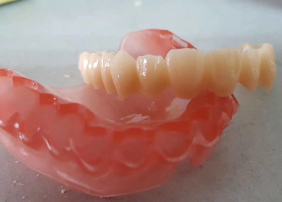 Realistische Digitale Gegevensoem 3D Gedrukte Tandmodellen voor Tandarts Study